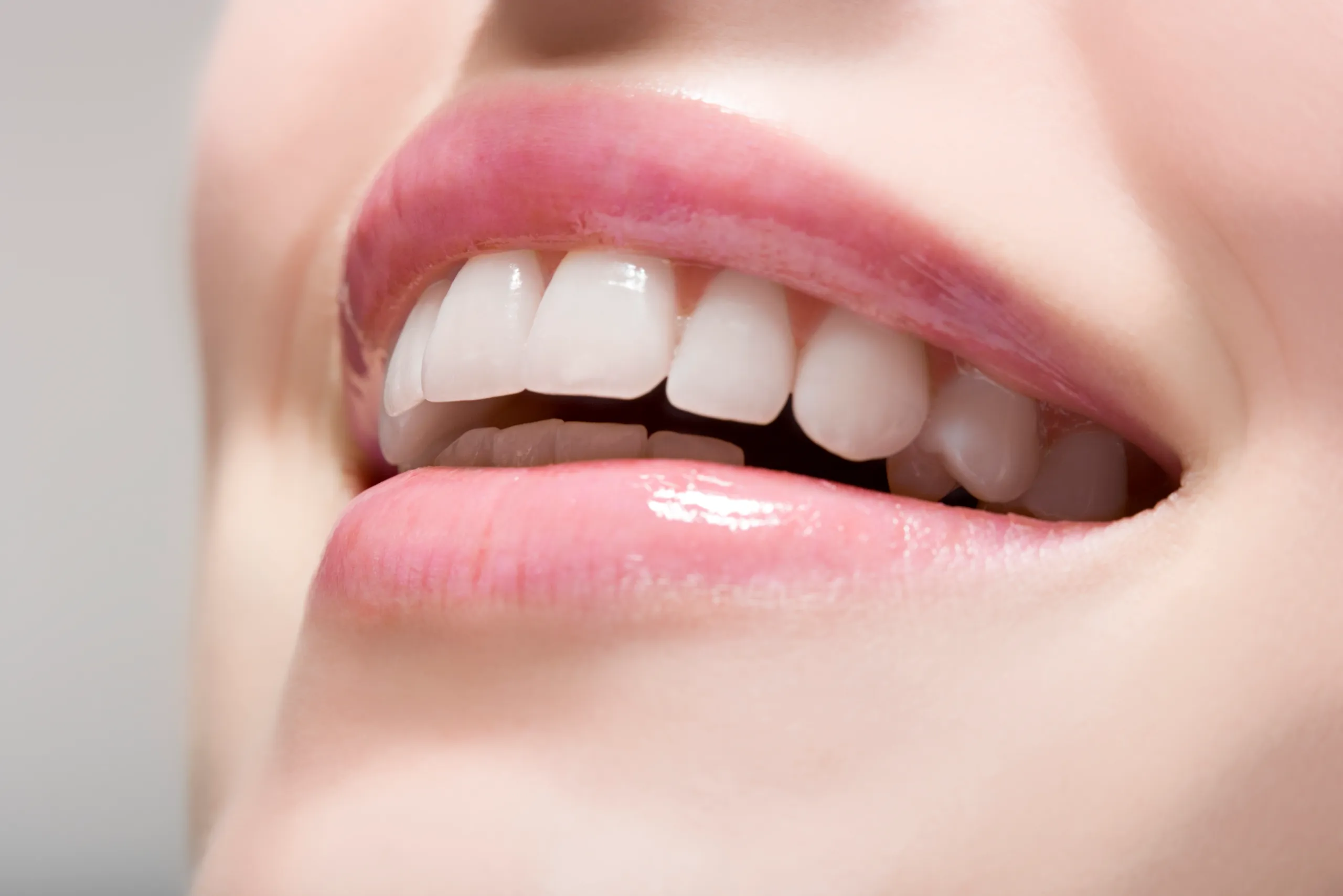 Laser Teeth Whitening FAQs Basingstoke