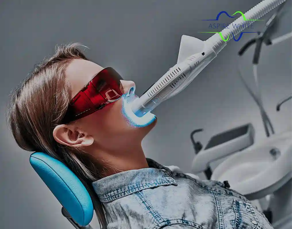 1 Hour Teeth Whitening with Aspire White Basingstoke